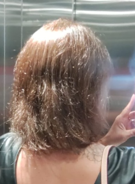Antes do cronograma capilar personalizado — resultado 1
